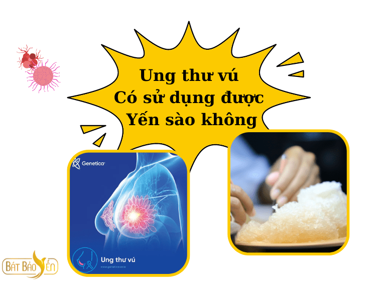 Ung thư vú có sử dụng yến được không Bát Bảo Yến